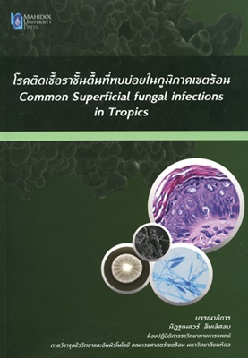 โรคติดเชื้อราชั้นตื้นที่พบบ่อยในภูมิภาคเขตร้อน = Common superficial fungal infections in tropics