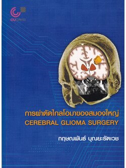 การผ่าตัดไกลโอมาของสมองใหญ่ = Cerebral glioma surgery