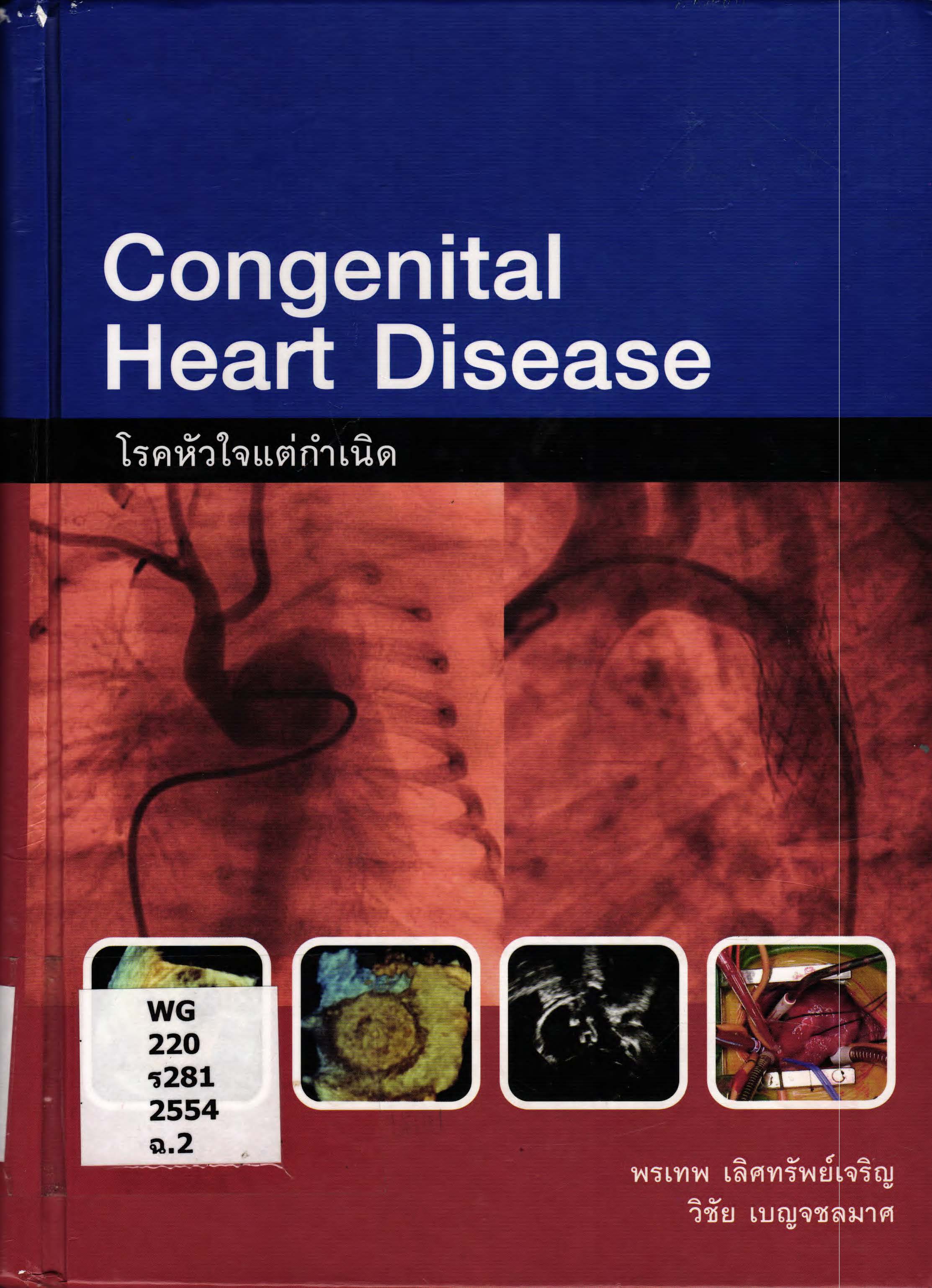 โรคหัวใจพิการแต่กำเนิด Congentinal heart diseases