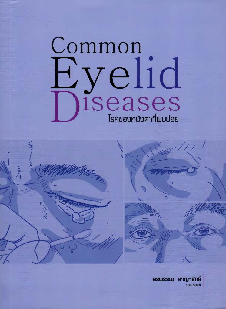 โรคของหนังตาที่พบบ่อย = Common eyelid diseases
