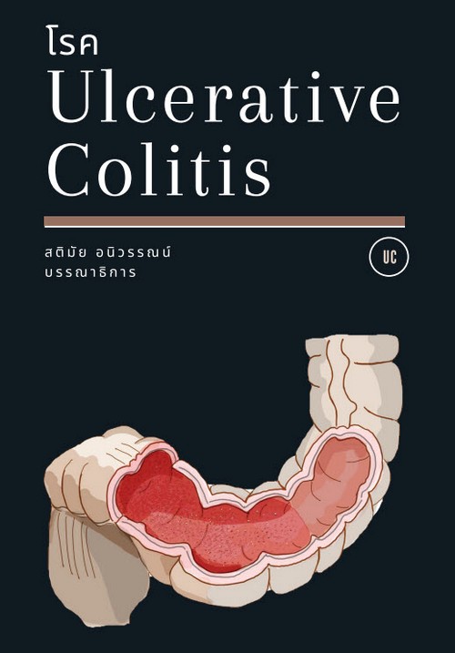 โรค Ulcerative colitis