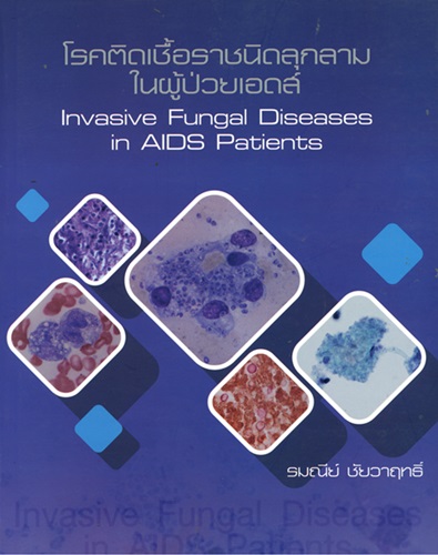 โรคติดเชื้อราชนิดลุกลามในผู้ป่วยเอดส์ = Invasive fungal diseases in AIDS patients