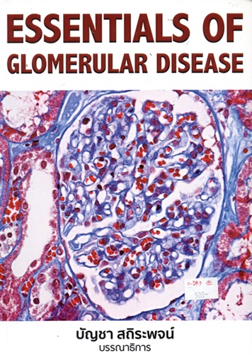 Essentials of glomerular disease