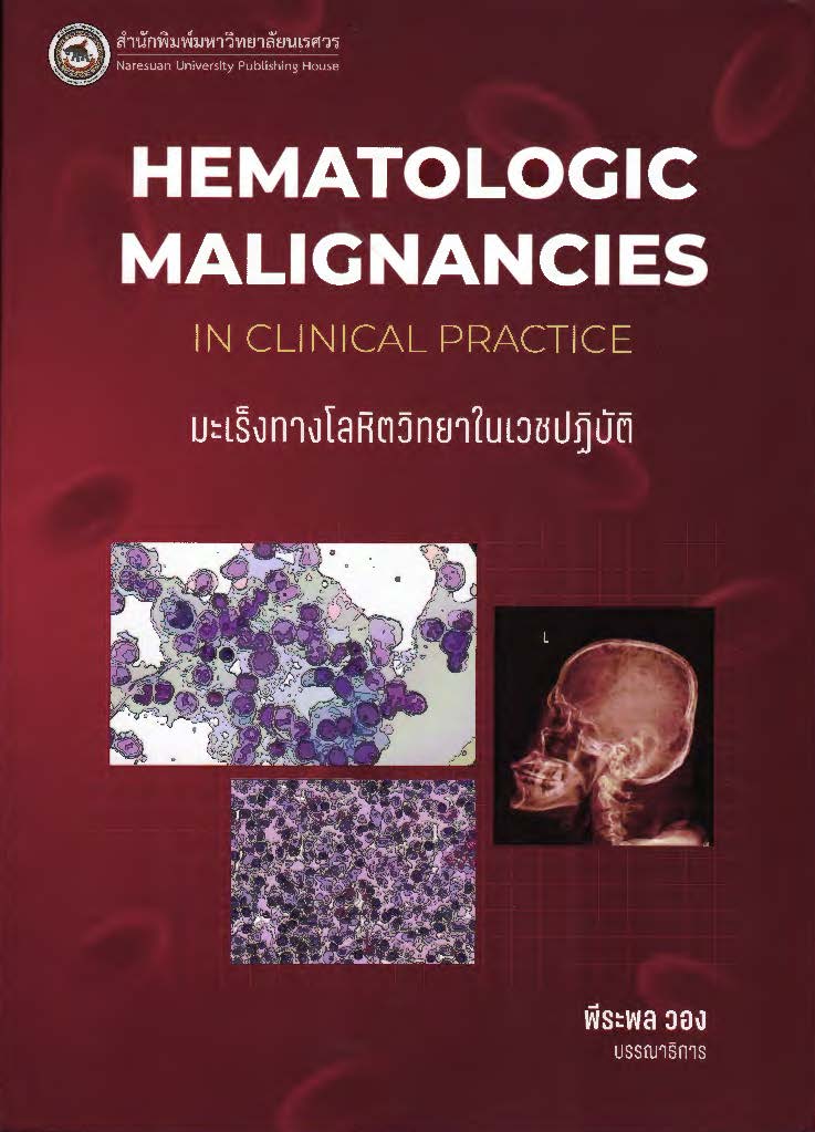 มะเร็งทางโลหิตวิทยาในเวชปฏิบัติ = Hematologic malignancies in clinical practice