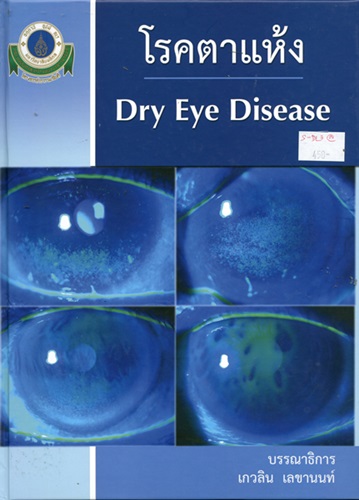 โรคตาแห้ง = Dry Eye Disease