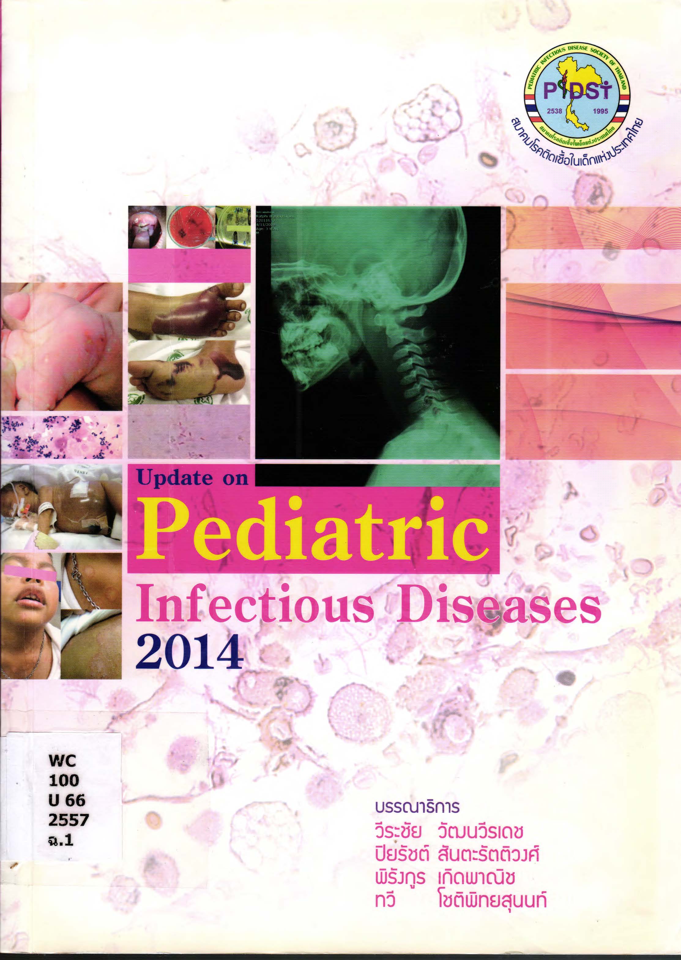 Update on pediatric Infectious diseases 2014