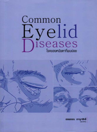 โรคของหนังตาที่พบบ่อย = Common eyelid diseases