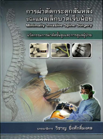 การผ่าตัดกระดูกสันหลัง ชนิดแผลเล็กบาดเจ็บน้อย : นวัตกรรมการผ่าตัดชั้นสูงและการดูแลผู้ป่วย = Minimally invasive spine surgery