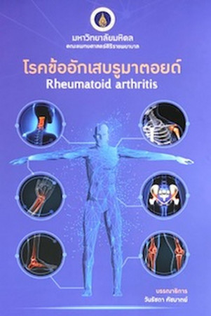 โรคข้ออักเสบรูมาตอยด์ = Rheumatoid arthritis