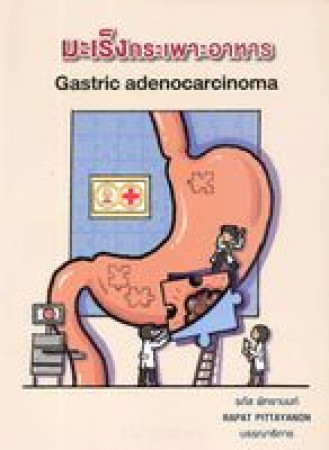 มะเร็งกระเพาะอาหาร = Gastric adenocarcinoma