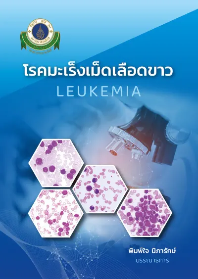 โรคมะเร็งเม็ดเลือดขาว (LEUKEMIA)